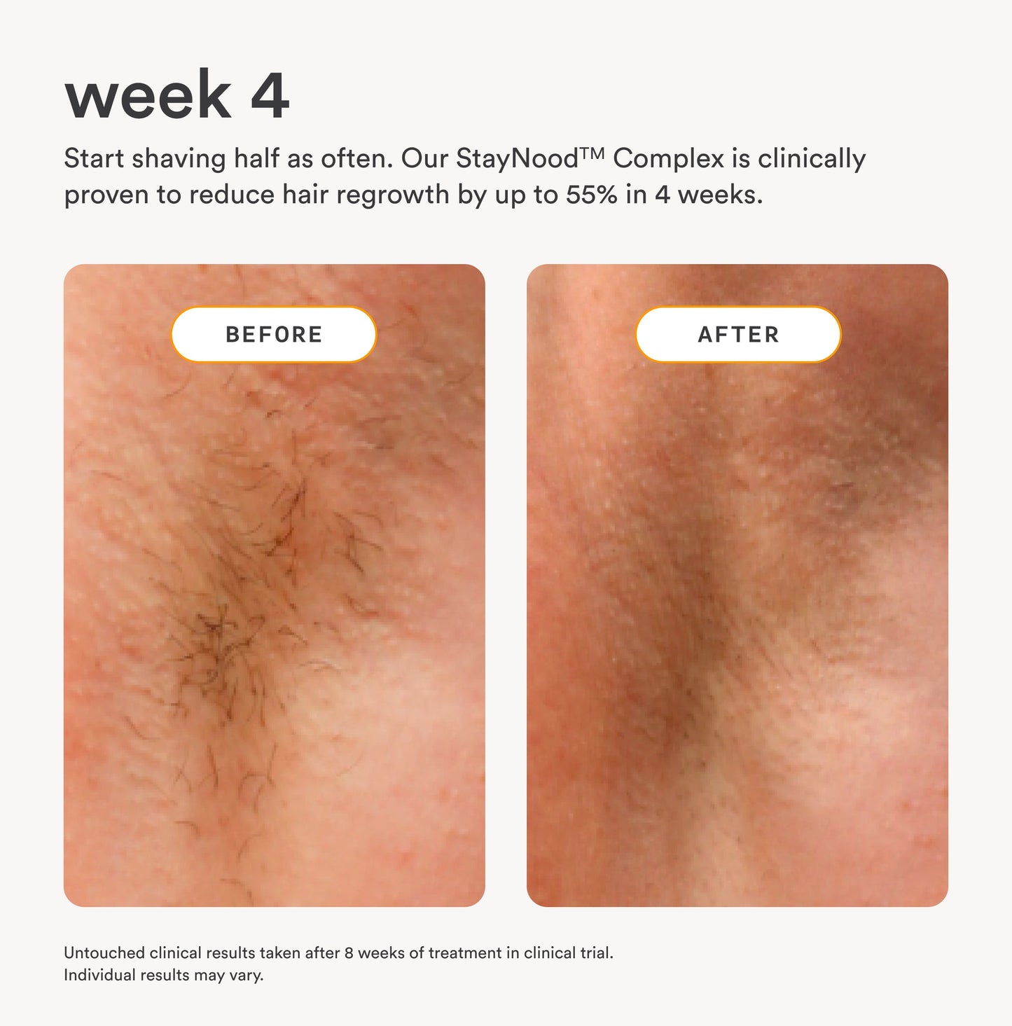 The Nood Serum